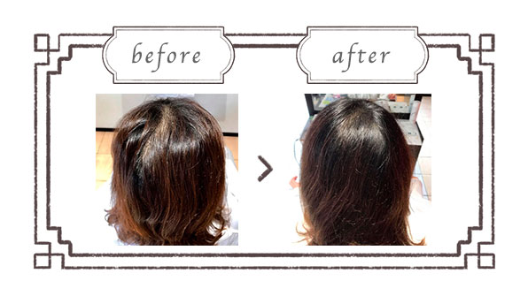 ヒト幹細胞培養液の頭⽪マッサージ|エステサロン六甲道 ヒト幹細胞培養液の頭⽪マッサージ